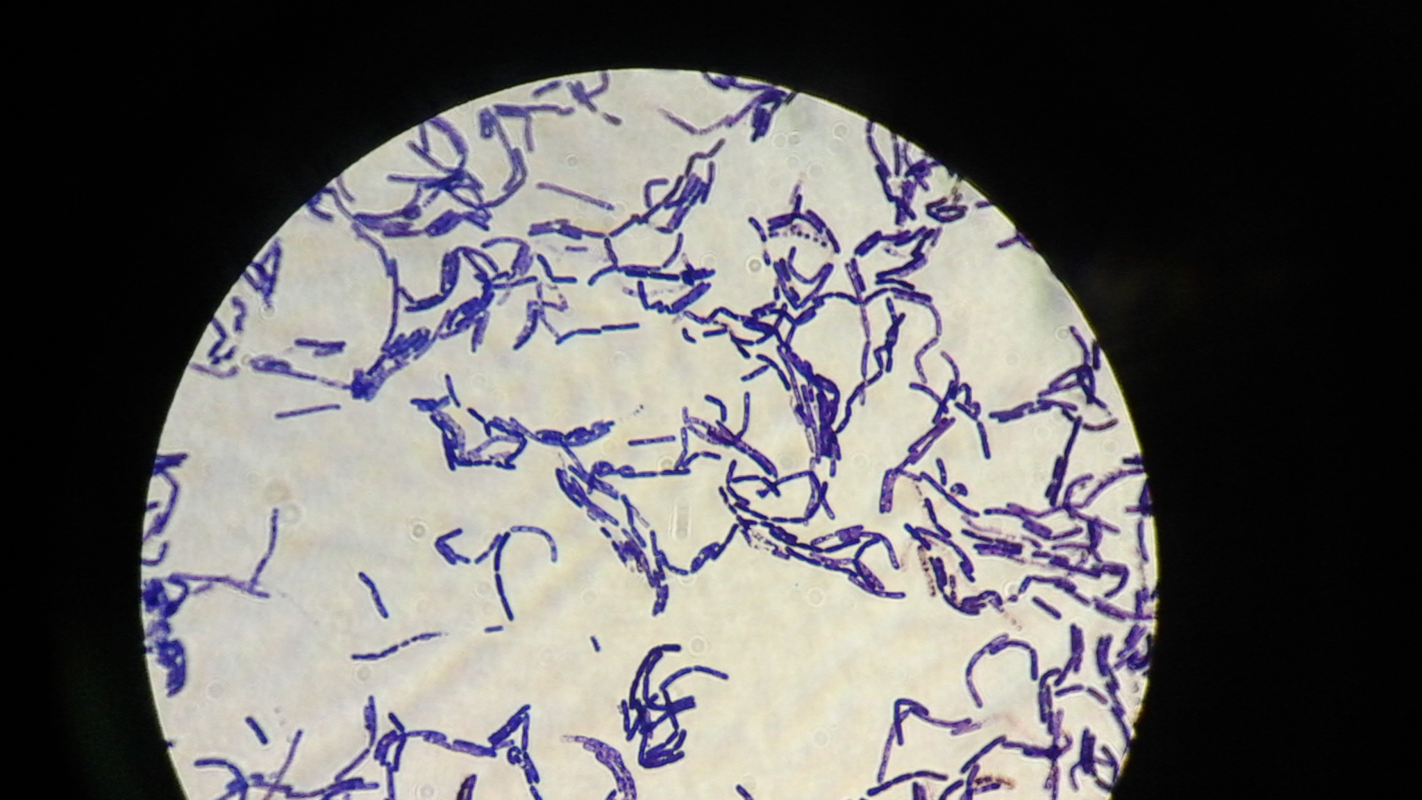 Микропрепарат бактерий. Bacillus megaterium. Препараты с Bacillus megaterium. Bacillus megaterium колонии. Bacillus megaterium на чашке Петри.
